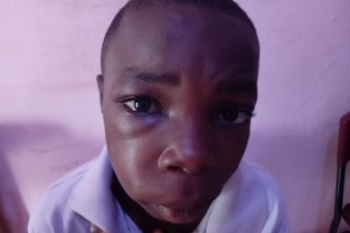 Swarm of Bees Attacks Mim